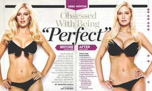 Reprodução - Heidi Montag Reprodução - Heidi Montag