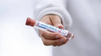 Estudo mostra confirma circula��o da variante amaz�nica no Paran�