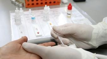 Londrina realiza campanha de testagem r�pida de ISTs